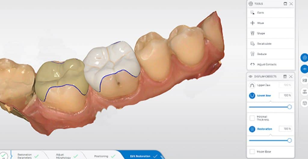 Amalgam Remediation Rostock Zahnärzte Frankfurt